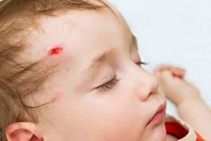 Wisconsin accident lawyer, Wisconsin injury attorney